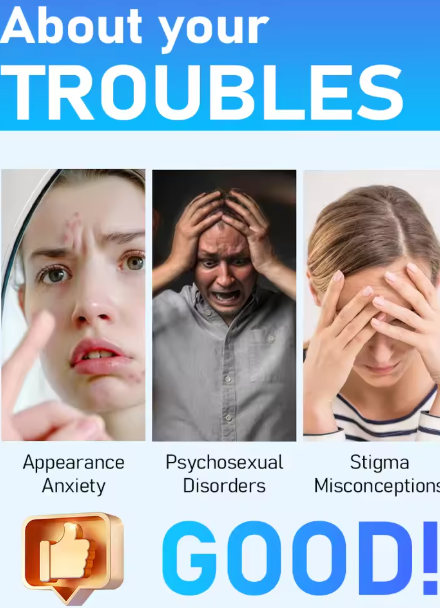 1st generation upgraded wart remover ⸴ Wart treatment ⸴ Fast