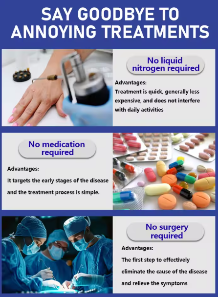 1st generation upgraded wart remover ⸴ Wart treatment ⸴ Fast