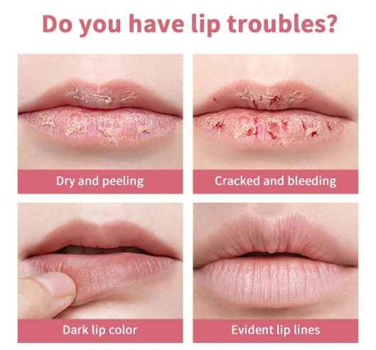 Vitamin E Pink Honey Lip Balm β Natural Tinted Care